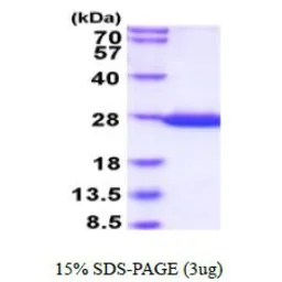 GST protein (active). GTX66882-pro