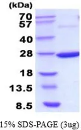 Idnk protein, His tag (active). GTX66895-pro