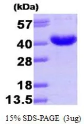 Human AKR7A3 protein, His tag (active). GTX66917-pro