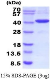 Human CA8 protein, His tag (active). GTX66933-pro