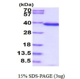 Human Cyclophilin E protein, His tag (active). GTX66957-pro