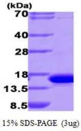 Human Galectin 9 protein, His tag (active). GTX67005-pro