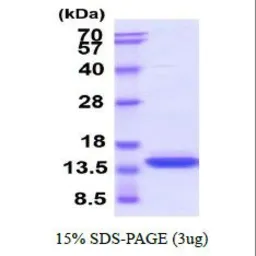 Human GM-CSF protein (active). GTX67016-pro