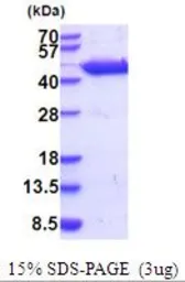 Mouse GOT1 protein, His tag (active). GTX67021-pro
