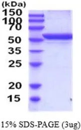 Rat GPT protein, His tag (active). GTX67026-pro