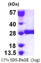 Human GSTM3 protein, His tag (active). GTX67038-pro