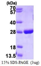 Human GSTP1 protein, His tag (active). GTX67040-pro