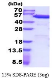Human PDIA6 protein, His tag (active). GTX67107-pro