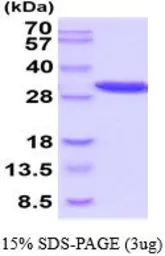 Mouse PGAM1 protein, His tag (active). GTX67111-pro