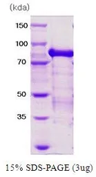Human PRMT1 protein, His and MBP tag. GTX67137-pro