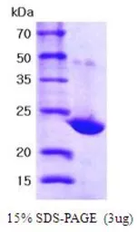 Human PRX I protein, His tag (active). GTX67142-pro