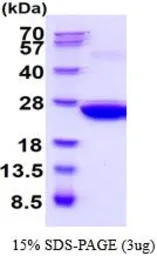 Mouse PRX I protein, His tag (active). GTX67143-pro
