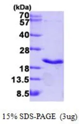 Human TNF beta protein, His tag (active). GTX67169-pro
