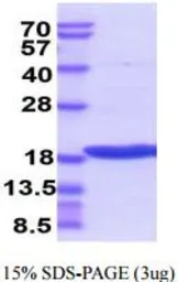 Human TRAIL protein (active). GTX67171-pro