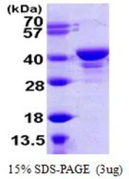 Human UCHL5 protein, His tag (active). GTX67180-pro