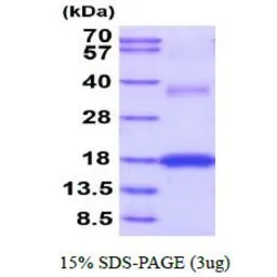 Mouse VEGFA protein, His tag (active). GTX67184-pro