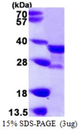 Human NAT1 protein, His tag. GTX67188-pro