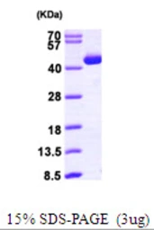 Human ACAT2 protein, His tag. GTX67189-pro