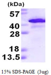 Human Alcohol dehydrogenase 1A protein, His tag. GTX67194-pro