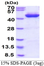 Human Alcohol dehydrogenase 1C protein, His tag. GTX67196-pro