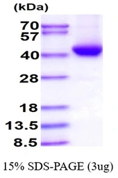 Human ADH5 protein, His tag. GTX67198-pro