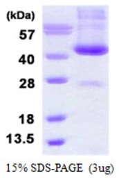 Human ADH6 protein, His tag. GTX67199-pro