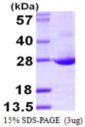 Human AES protein, His tag. GTX67202-pro