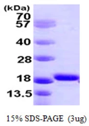 Human Iba1 protein, His tag. GTX67205-pro