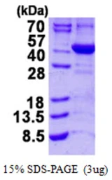 Human ALAD protein, His tag. GTX67208-pro