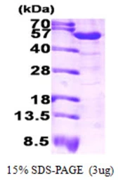 Human ALDH1A1 protein. GTX67209-pro