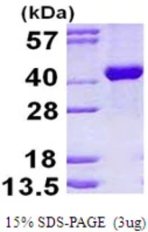 Human Aldolase B protein, His tag. GTX67210-pro