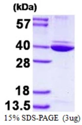 Human Annexin A8 like 2 protein, His tag. GTX67213-pro