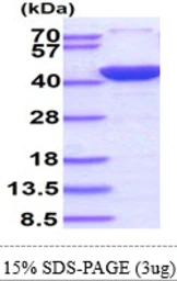 Human Annexin II protein, His tag. GTX67216-pro