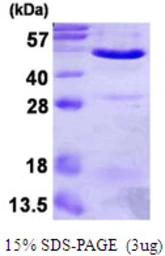 Human Annexin VII protein, His tag. GTX67221-pro