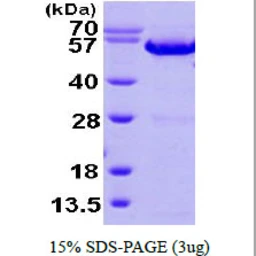 Human Annexin XI protein, His tag. GTX67222-pro