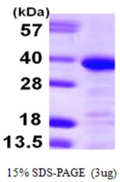 Human Annexin A13 protein, His tag. GTX67223-pro