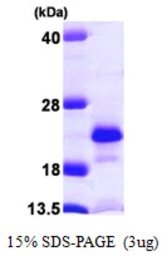 Human NUDT2 protein, His tag. GTX67224-pro