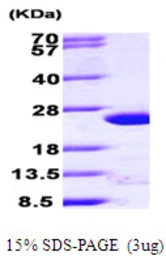 Human ARF4 protein, His tag. GTX67230-pro