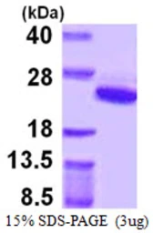 Human ARF5 protein, His tag. GTX67232-pro