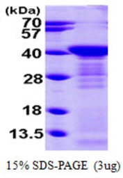 Human Arginase 1 protein, His tag. GTX67234-pro