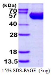 Human ASL protein, His tag. GTX67238-pro