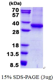 Human ASMT protein, His tag. GTX67239-pro