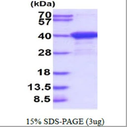 Human Aspartoacylase protein, His tag. GTX67241-pro