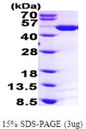 Human ASS1 protein, His tag. GTX67243-pro