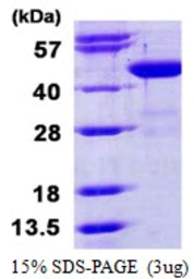 Human BCAT1 protein, His tag. GTX67249-pro