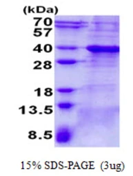 Human BCL7A protein, His tag. GTX67250-pro