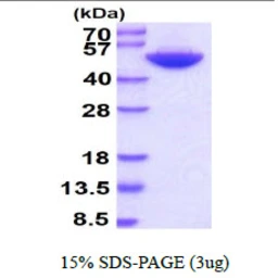 Human BHMT protein, His tag. GTX67251-pro
