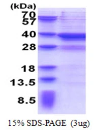 Human MPPED2 protein, His tag. GTX67256-pro