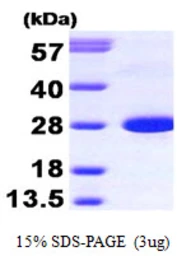 Human Calbindin protein. GTX67260-pro
