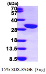 Human Calretinin protein, His tag. GTX67261-pro